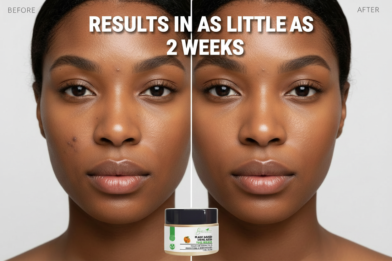 Bconscious Naturals™ Vegan & Natural Plant-Based Kojic Acid Face Moisturizer
Infused with Vitamin E & C for Dark Spots, Blemishes, and Skin Discoloration