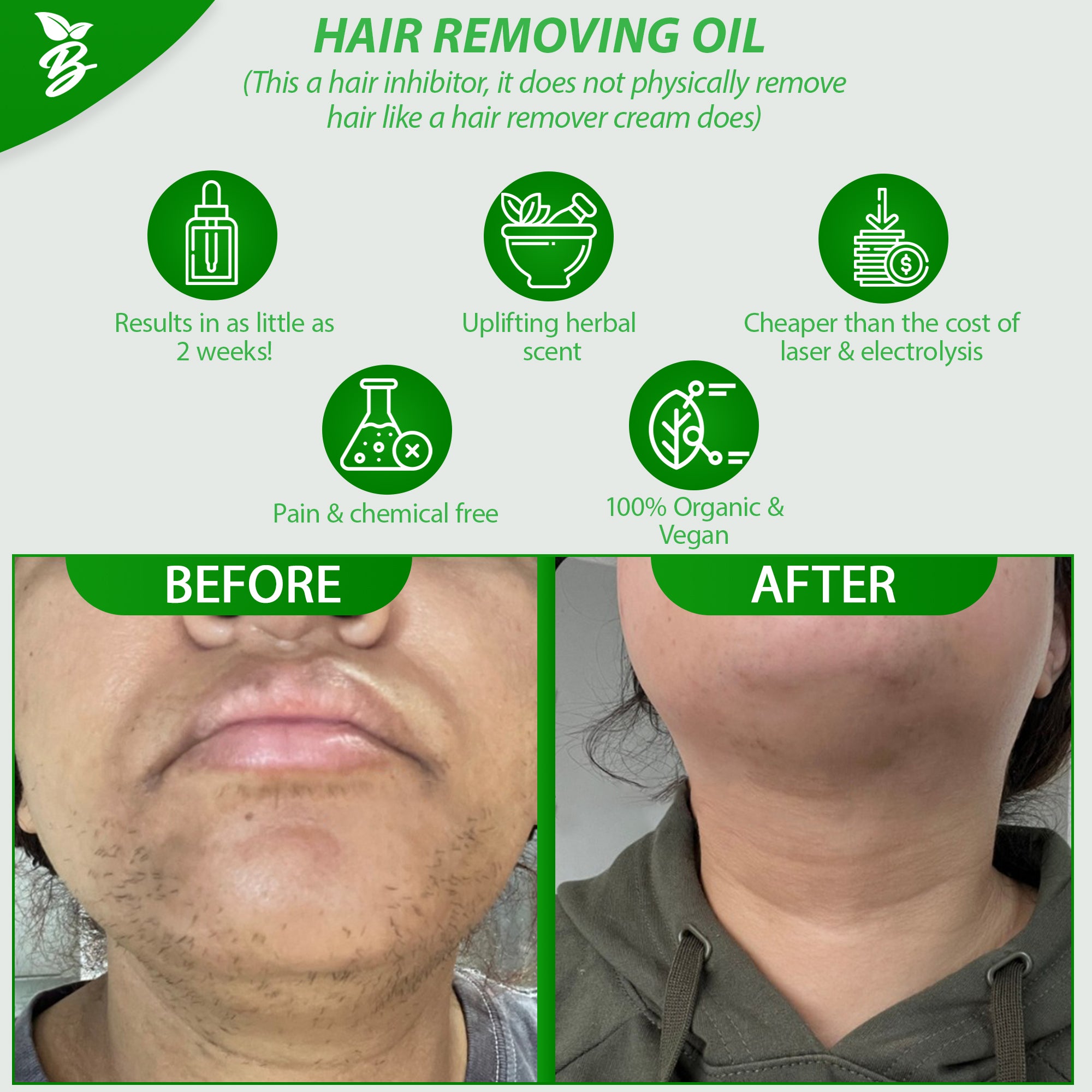 Pcos/Hirsutism Vegan Natural Face/Body Hair Removal Oil(Inhibits Chin Hair & Slows Down Hair Growth)