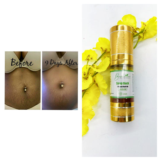 Bconscious Naturals™ SnapBack Stretchmark Oil
Natural Stretch Mark Treatment for Smooth, Firm, and Rejuvenated Skin