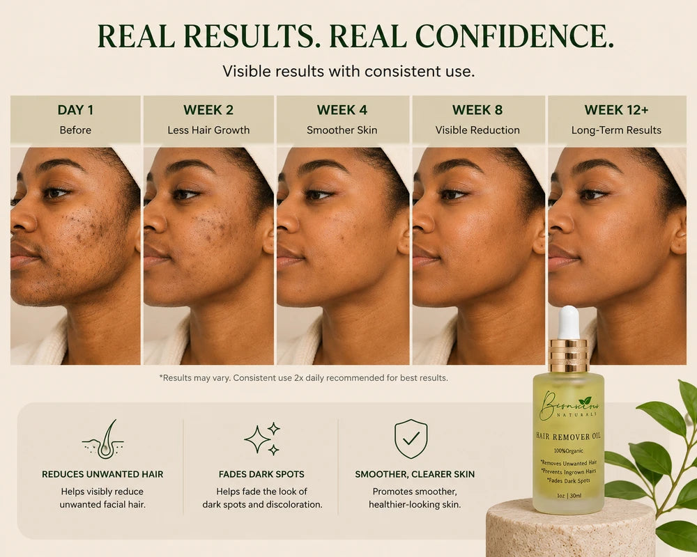 Bconscious Hair Removal Oil- Helps Reduce the Appearance of Unwanted Facial Hair, Ingrown Hairs & Dark Spots