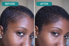 PCOS Hair Growth Oil for Women | Natural Scalp Support
