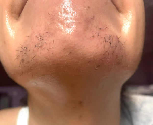 Before - Priya, 28