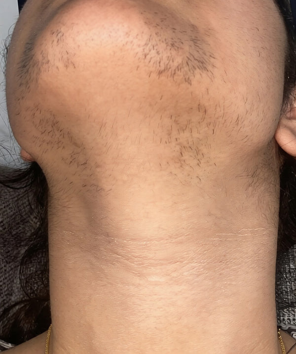 Before - Jasmine, 31