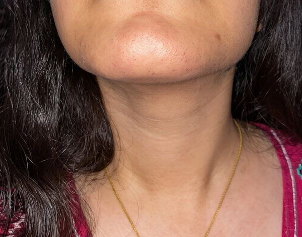 After - Jasmine, 31