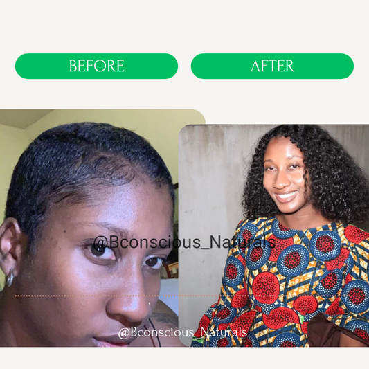 Natural hair growth oil to strengthen hair follicles for women struggling with pcos, also known as polycystic ovarian syndrome .
