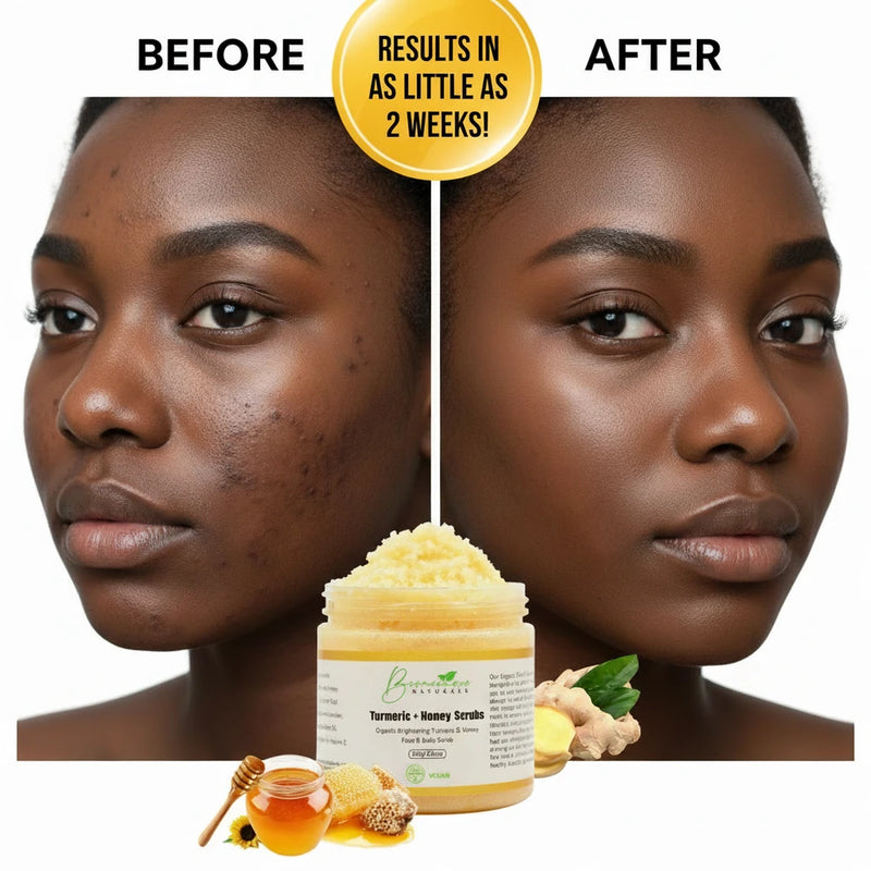 Turmeric Honey Ingrown Hair Scrub | Dark Spot Exfoliator