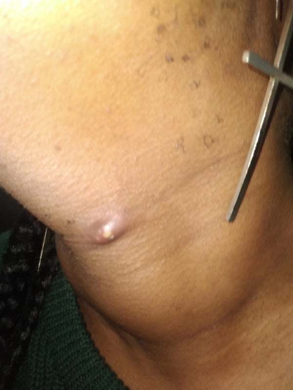Before - Nikita, 27