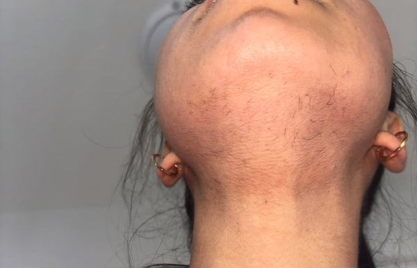 After - Aisha, 26