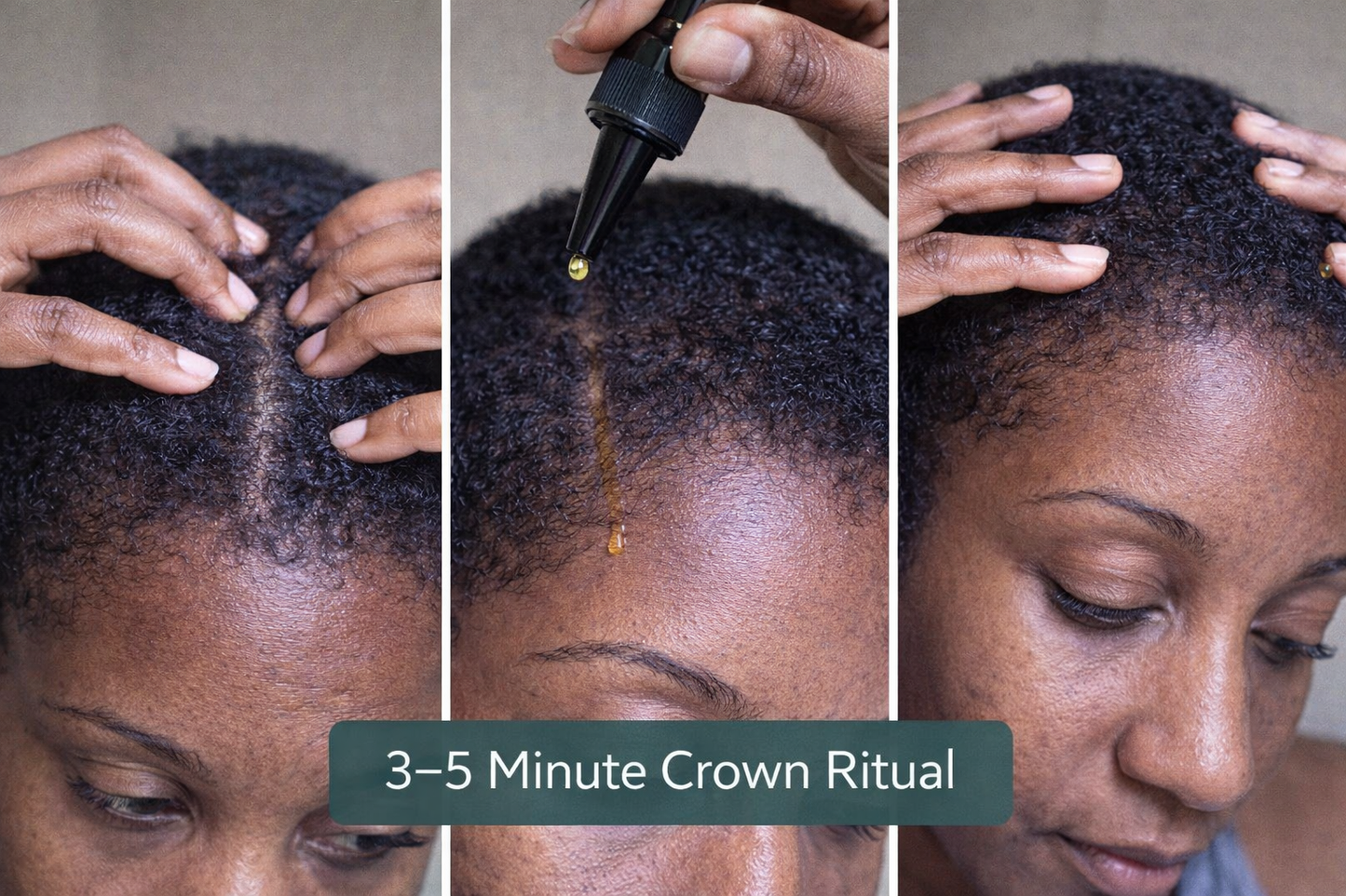 PCOS Hair Growth Oil for Women | Natural Scalp Support