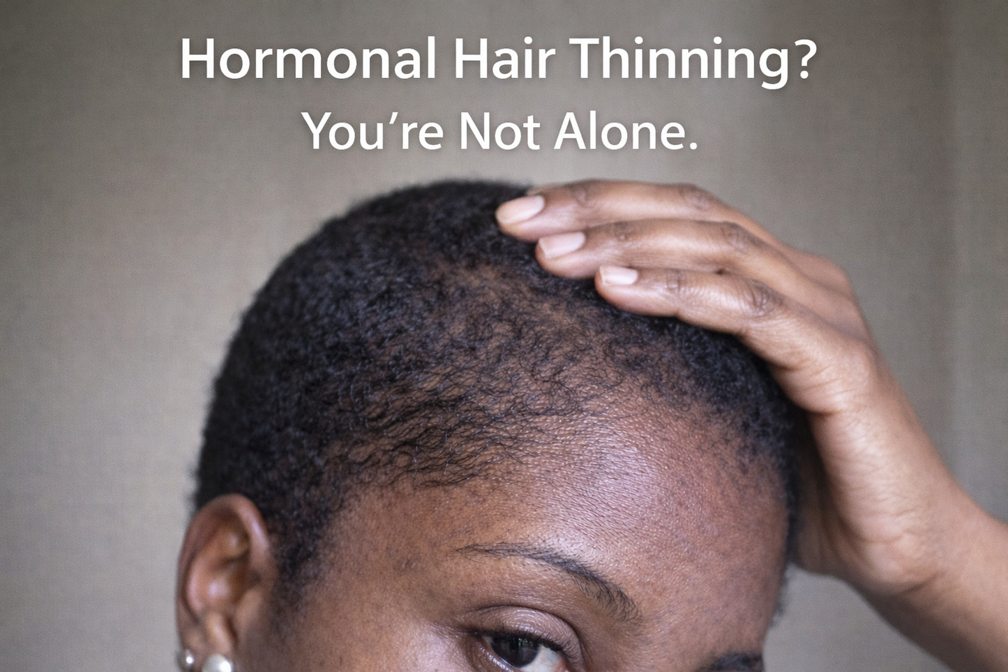 PCOS Hair Growth Oil for Women | Natural Scalp Support